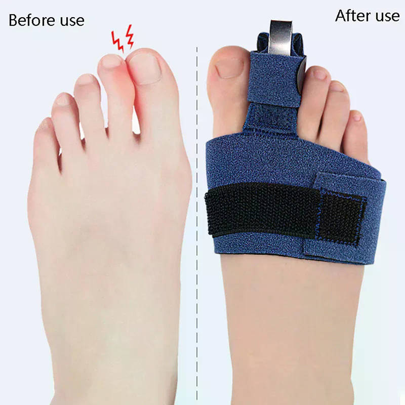 1Pcs Toe Corrector Toe Fractur – Ankle Brace Sock recenzja i cena